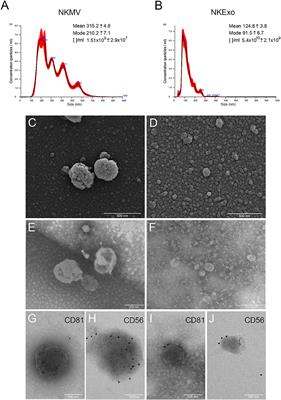 Natural-Killer-Derived Extracellular Vesicles: Immune Sensors and Interactors